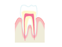 痛みに配慮した虫歯治療 戸越公園 品川区 の歯科 歯医者なら山手歯科クリニック戸越公園