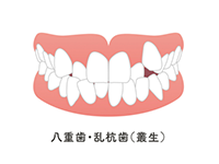 叢生（そうせい）