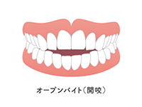 開咬（かいこう）