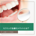 セラミック治療のメリットとは？
