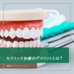 セラミック治療のデメリットはあるの？