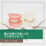矯正治療の対象となる不正咬合とは？①