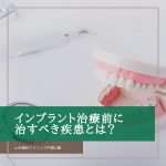 インプラント治療前に治すべき疾患とは？