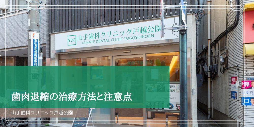 歯肉退縮の治療方法と注意点